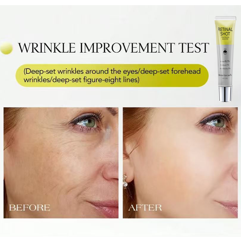 Retinal 0,1% Intensive Shot, c - Retinol Anti Wrinkle Cream avaliação e preço