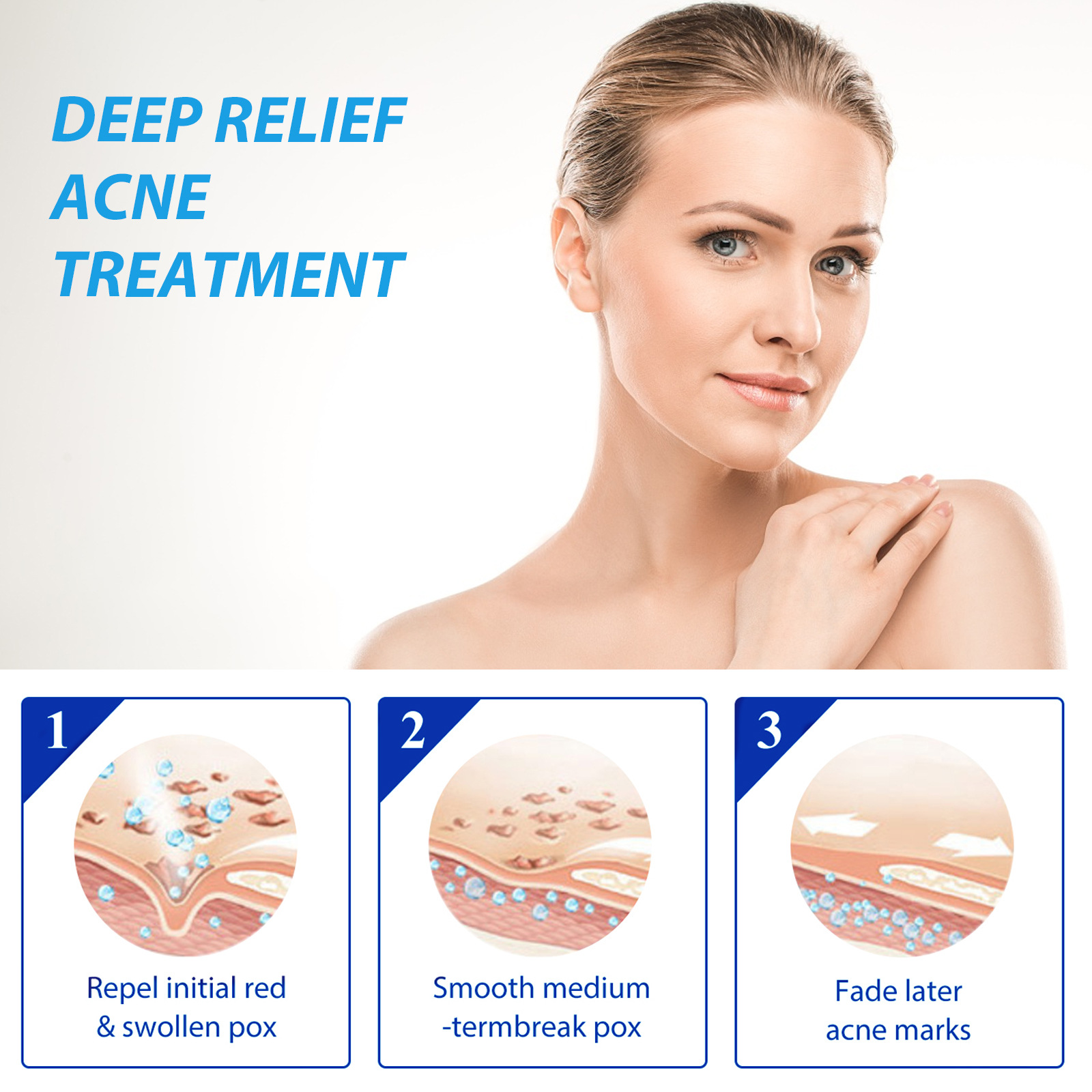 Eelhoe acne tratamento loção á - Salicylic Acid Blackhead Remover avaliação e preço