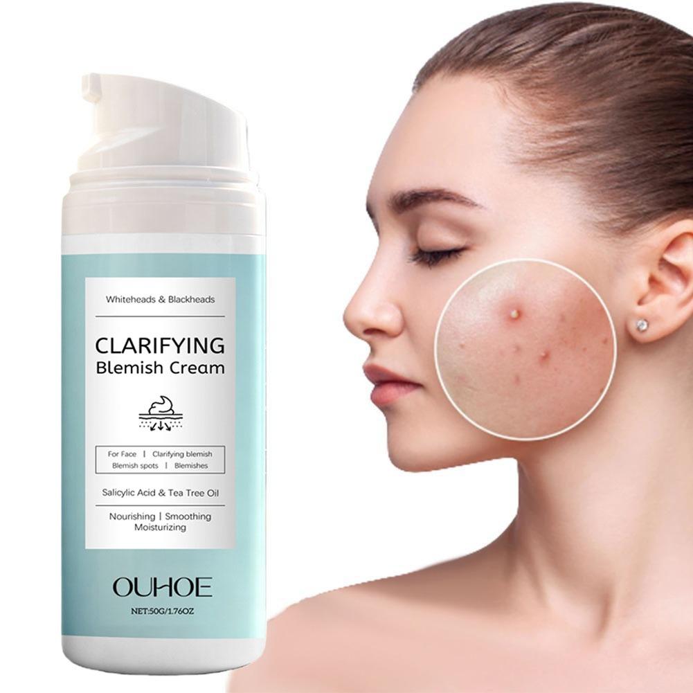 Creme Removedor de Acne com Ác - Salicylic Acid Blackhead Remover avaliação e preço